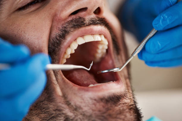 Best Emergency Root Canal Treatment in Edisto, SC