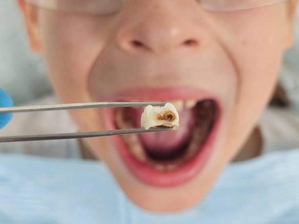 Best Cosmetic Emergency Dentistry in Edisto, SC