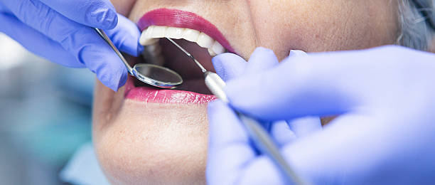 Best Emergency Tooth Extraction in Edisto, SC